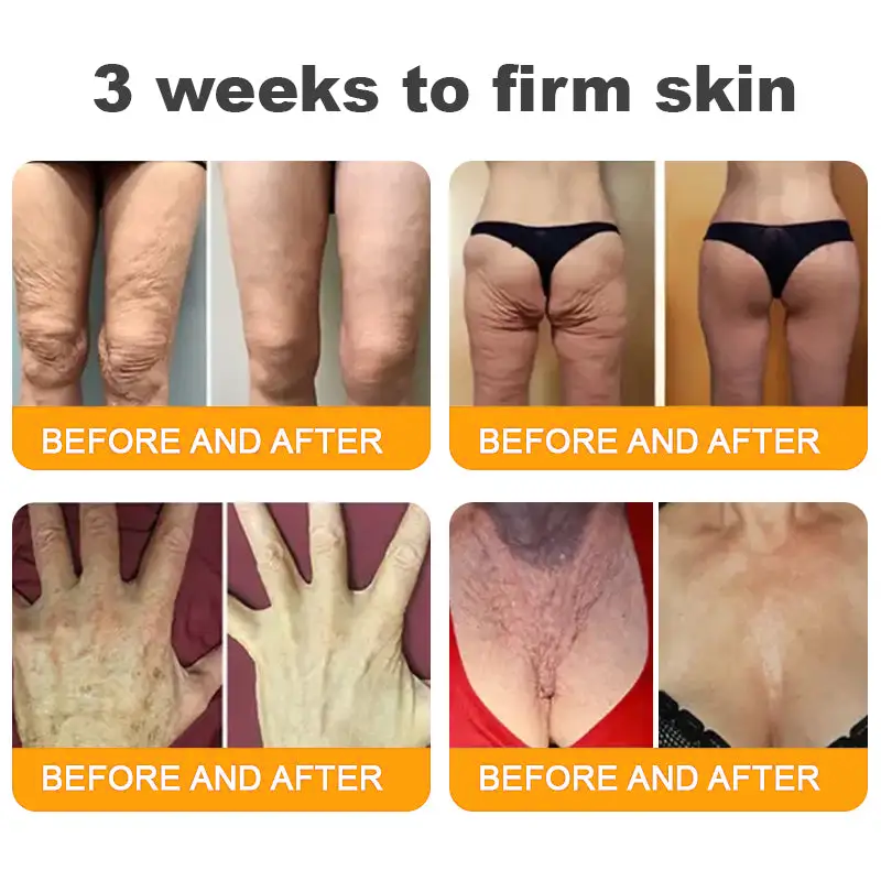Made and Shipped from AUS ✨ Pureluxo® Bee Venom Skin Restoration Cream ⏰ LAST DAY 80% OFF🛒
