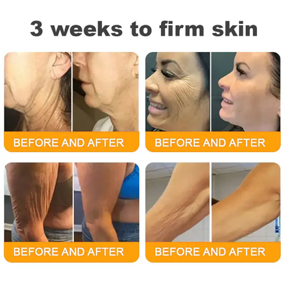 Made and Shipped from AUS ✨ Pureluxo® Bee Venom Skin Restoration Cream ⏰ LAST DAY 80% OFF🛒